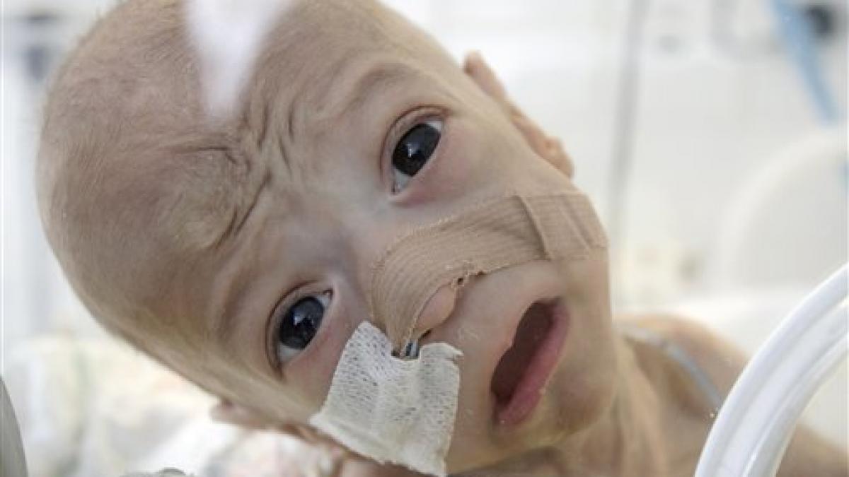 incredibil bebelusul salvat de coruptia din spitalele romanesti