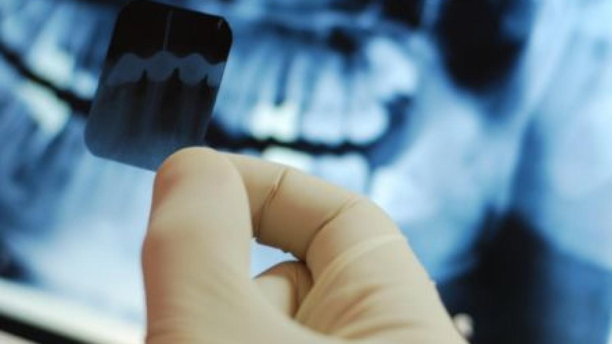 studiul care a panicat lumea tumorile pe creier provocate de o procedura medicala la care toti am