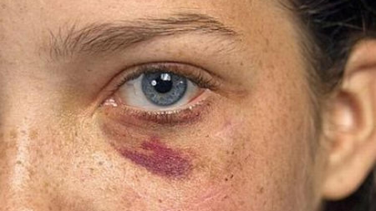 o tanara de 21 de ani dintr un sat din bistrita nasaud a fost batuta cu bestialitate de un barbat