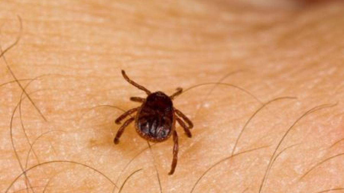 epidemia de capuse loveste in arad si sibiu zeci de persoane au ajuns la spital