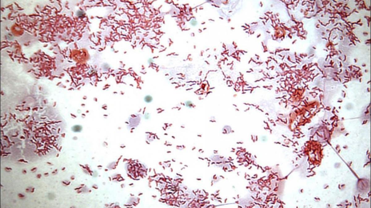 alimentul pe care il are oricine in casa vindeca bolile mai bine decat pastilele nu te mai feri sa