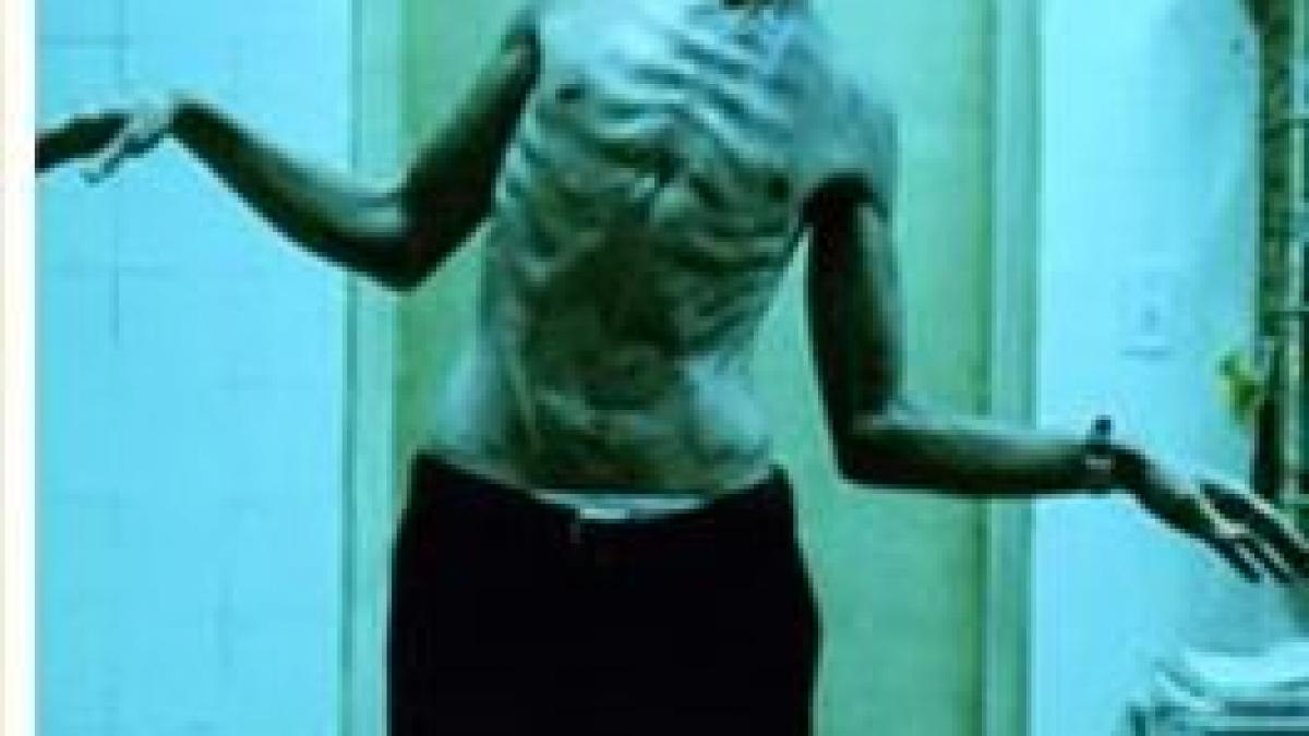 viata lui nu a mai fost la fel dupa acesta experienta la fiecare respiratie mi se vedeau coastele