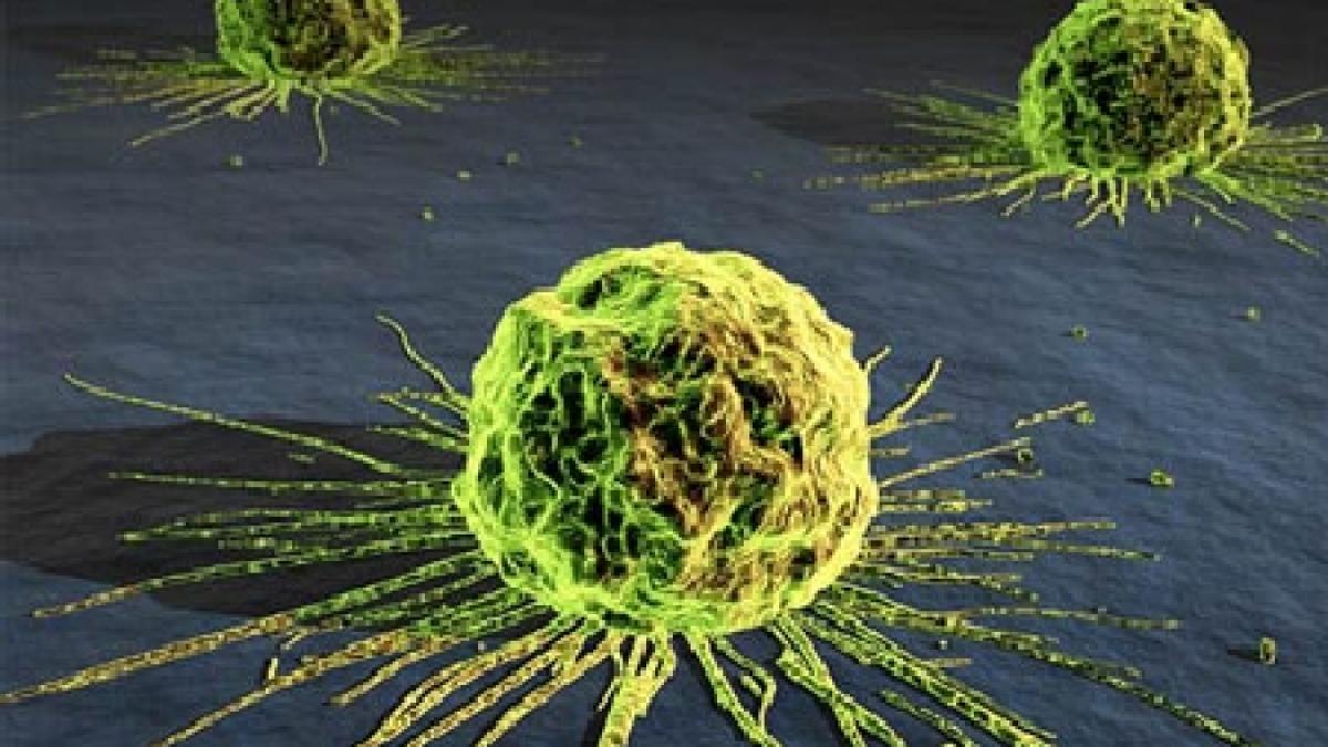 in intreaga lume unul din sase cancere este cauzat de infectii