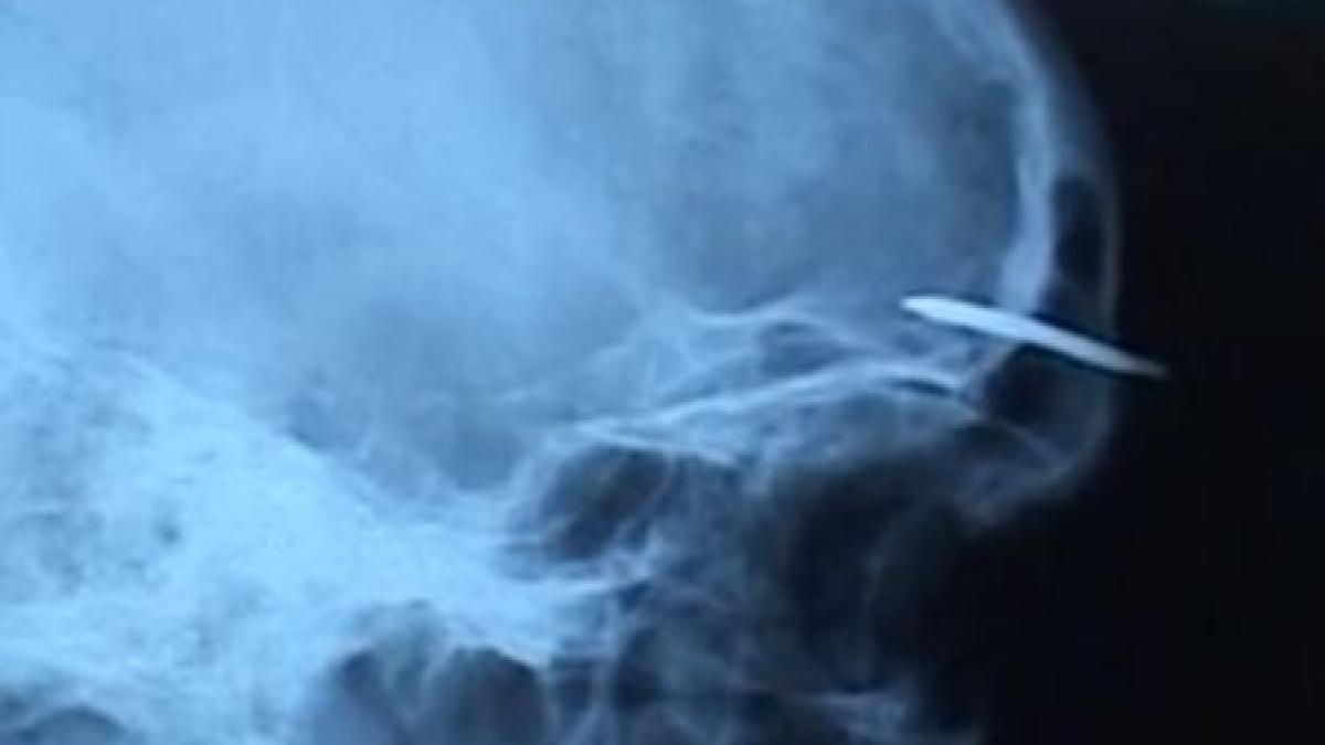 un detinut si a batut un cui in cap nemultumit de traiul din penitenciar