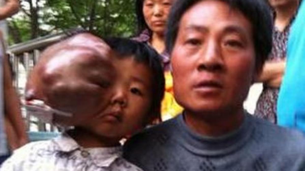 saracia ii rapeste dreptul la viata are numai cinci ani dar si a pierdut speranta