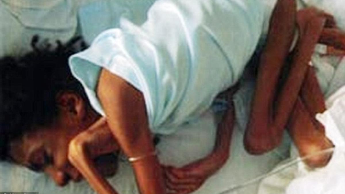 imagini care sfasie inima oricarui parinte cantarea 10 kilograme la varsta de 16 ani mama ei o lasa