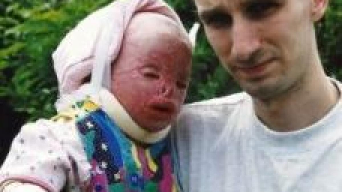 i am nenorocit viata copilei mele pompierii au crezut ca este o papusa arsa povestea socanta a