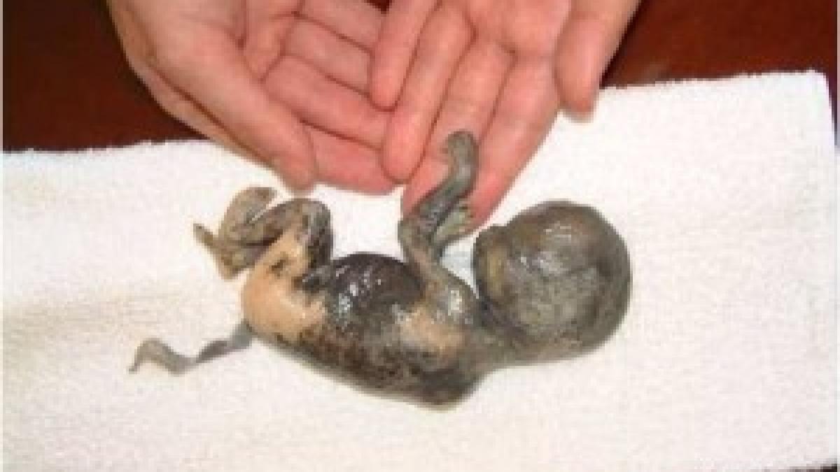 scandal de proportii mondiale doua mari puteri acorda sume colosale pentru avorturile ilegale din