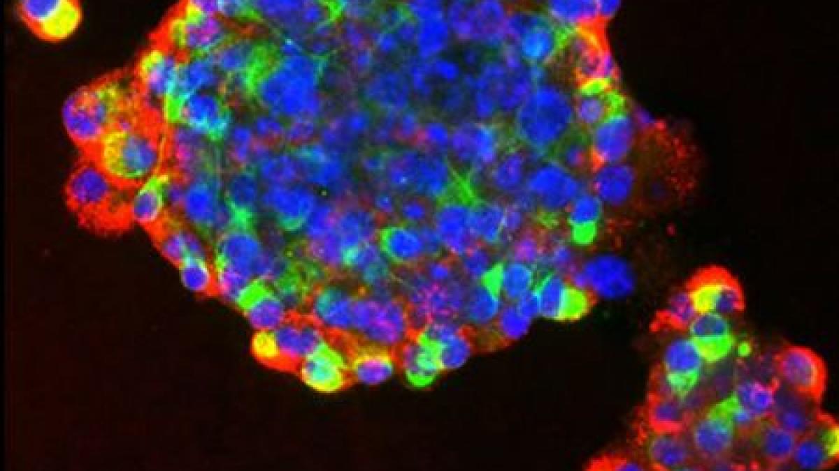 descoperirea care ofera speranta bolnavilor din intreaga lume o premiera mondiala in domeniul