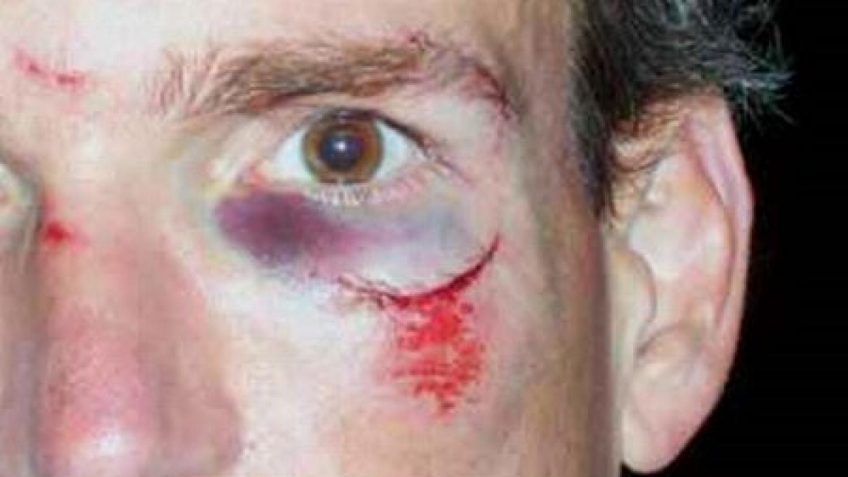 inca un incident care nu ne face cinste un fotoreporter polonez a fost batut si talharit la arad