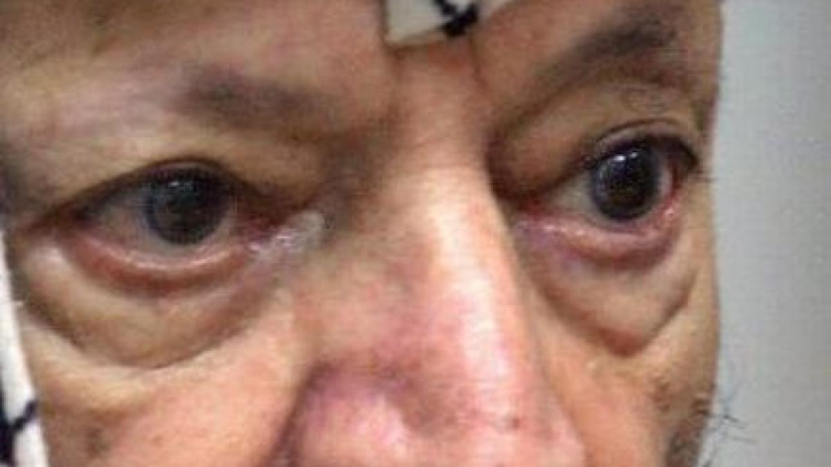 misterul din spatele mortii unui lider mondial ar fi fost otravit cu o substanta radioactiva