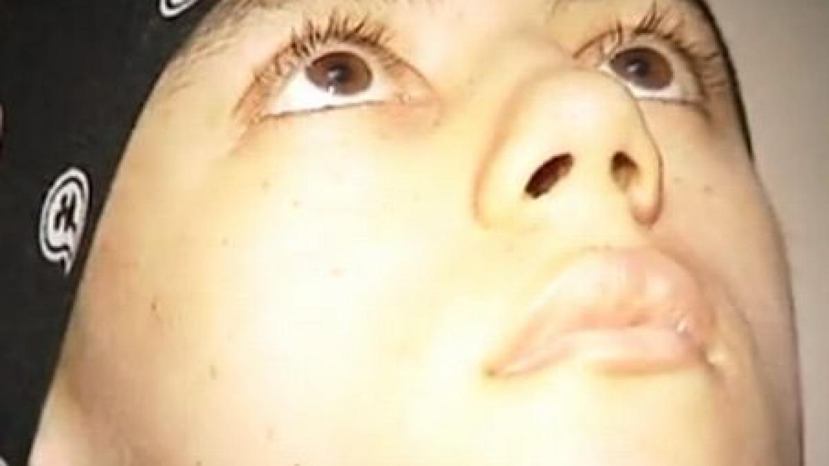 doar in romania e posibil asa ceva mutilarea vindecare pentru cancerul osos