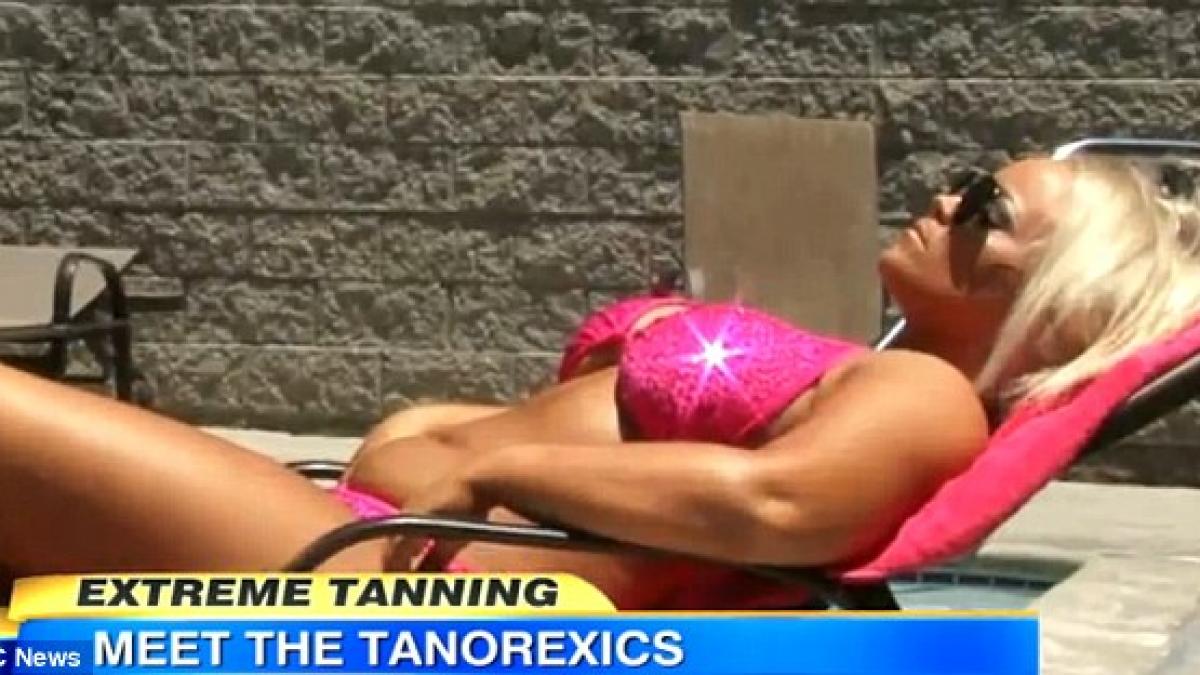 s a prajit 10 ani la solar iar acum arata ca o stafida nici cancerul nu m ar opri sa ma bronzez