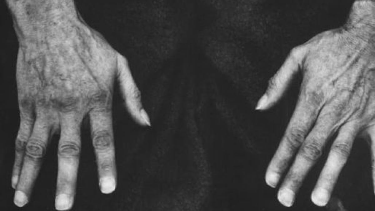 raul in forma sa pura el a fost calaul a sase milioane de oameni un medic de origine romana a