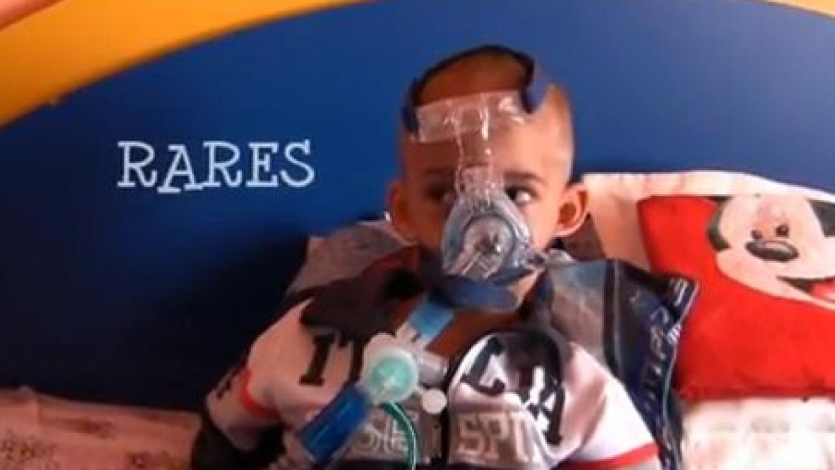 da o sansa la viata unui baietel de 3 anisori care nu poate respira singur