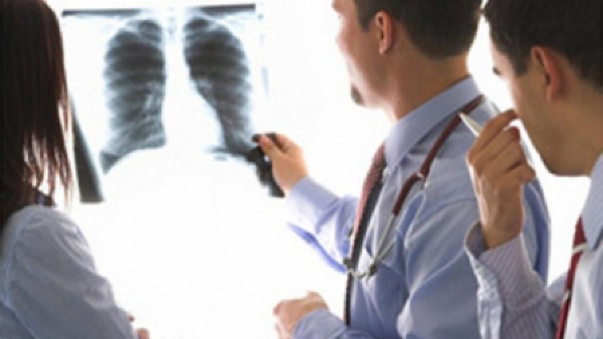 tratament miraculos contra tuberculozei o combinatie de medicamente ucide peste 99 din bacterie