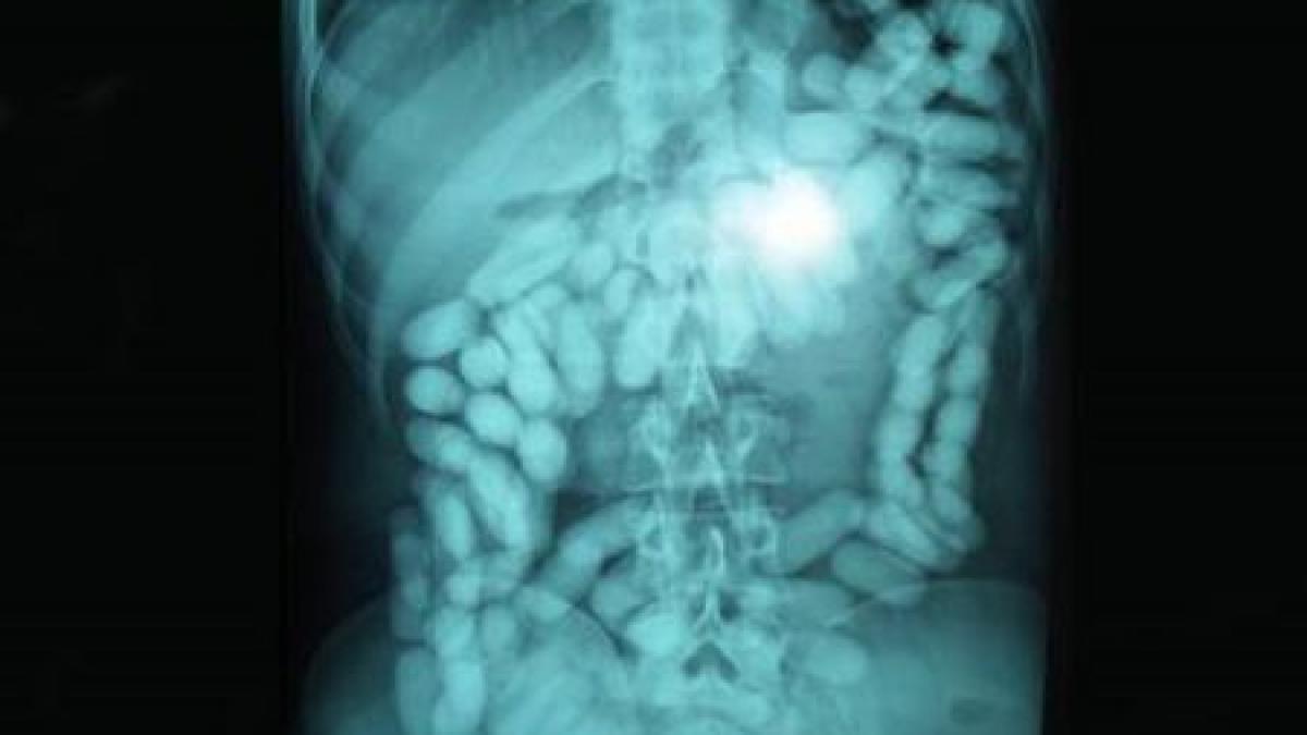 a carat un kilogram de droguri in stomac maramureseanul a fost prins pe aeroportul din new mexico