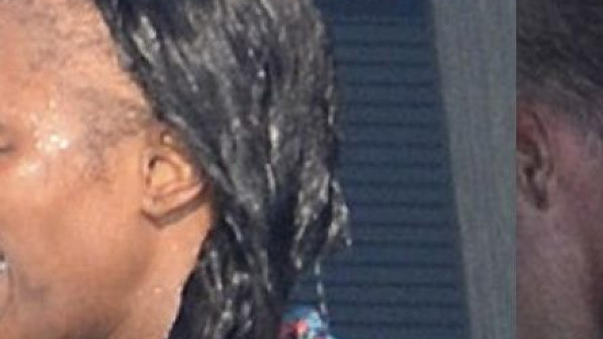 pretul socant al frumusetii cum a ajuns sa arate cel mai mare model al lumii ii cade parul a chelit