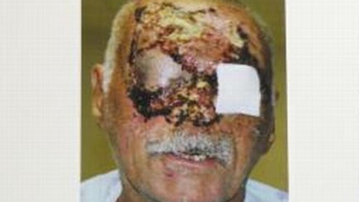 pur si simplu m a sfasiat m a muscat de fata mi a scos ochii interviu cu victima canibalului din