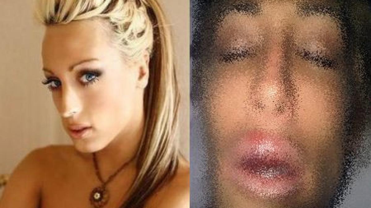 arata de parca i ar fi explodat fata s a desfigurat in cautarea frumusetii o transformare care te