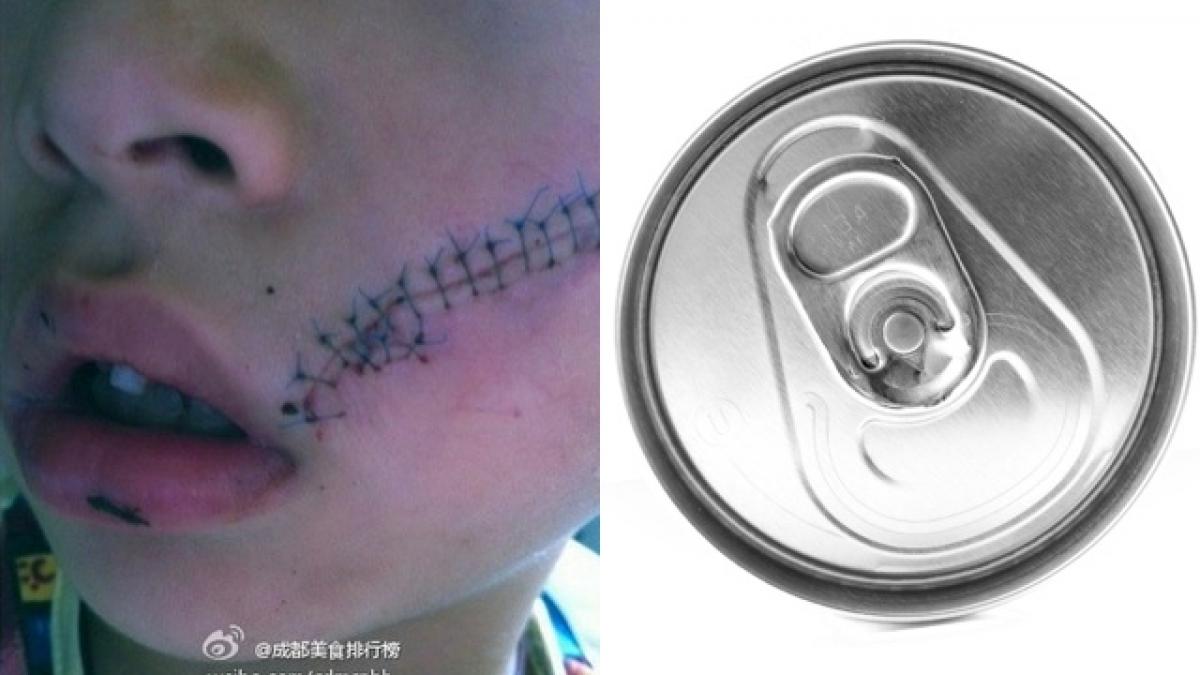 bautura pe care tu o adori era sa il ucida doza i a sectionat intreg obrazul