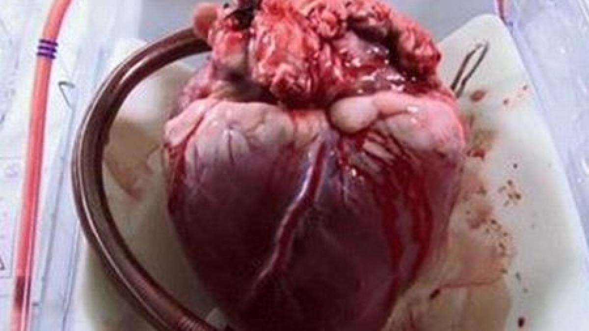 nu mi mai bate inima si nu mai am nici puls omul care traieste de patru luni fara inima