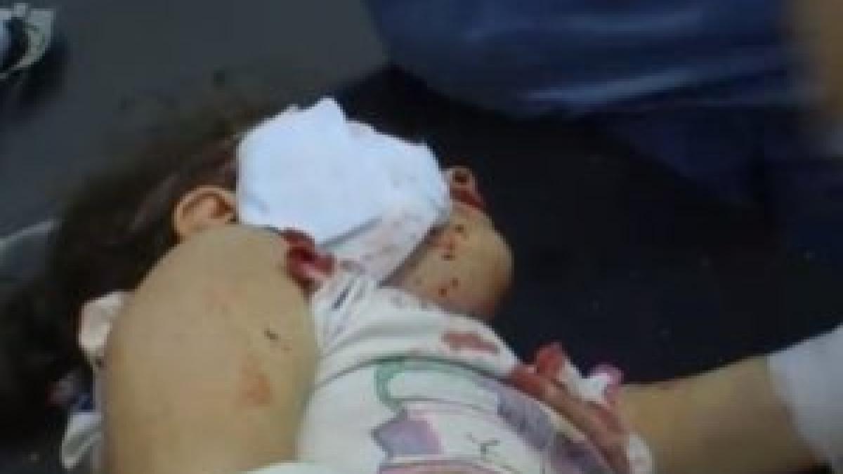 imagini socante din siria o fetita de 4 ani a fost impuscata de un lunetist