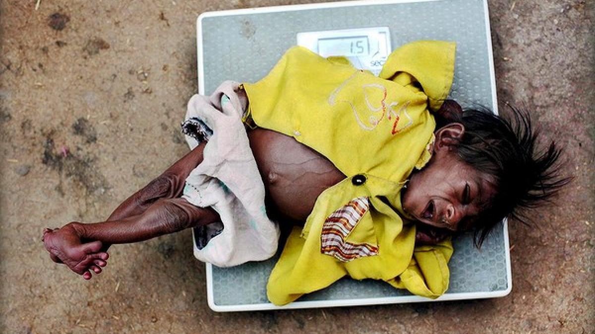 este o rusine nationala tara foamei in care 40 dintre copii sunt malnutriti