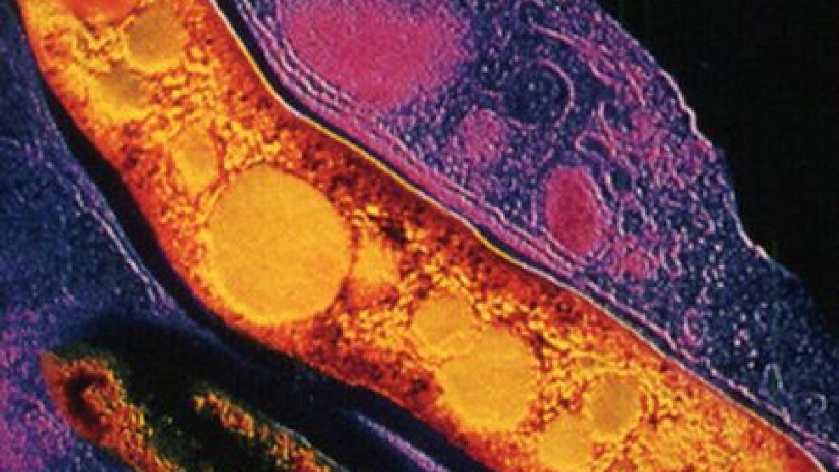 dusmanul nevazut care omoara milioane de oameni din intreaga lume medicii sunt neputinciosi in fata