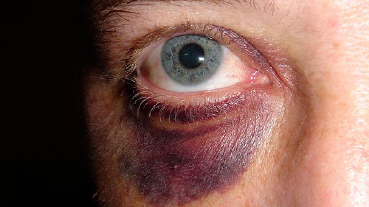 oamenii care ar trebui sa ne apere suspectati ca au batut si umilit fara motiv un barbat