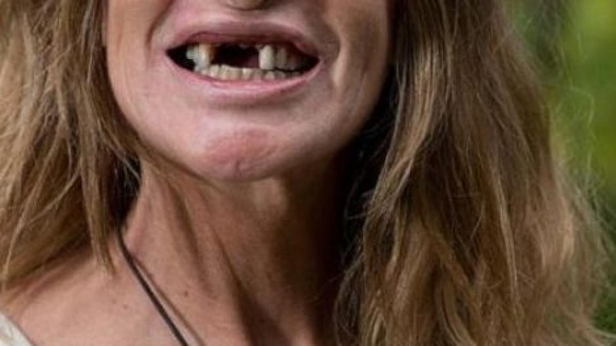 este cel mai cunoscut model din anglia dar a socat cu aparitia asta cum a ajuns sa arate in halul