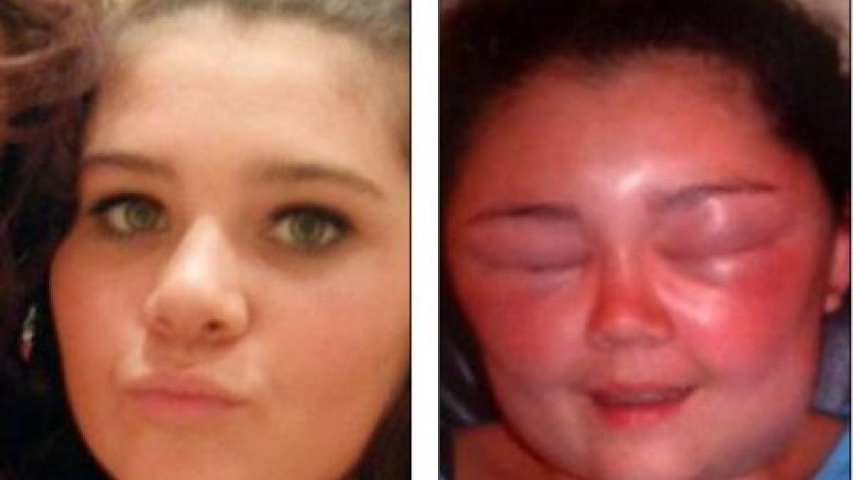 arat ca un monstru din cauza unui produs pe care toate femeile il folosesc