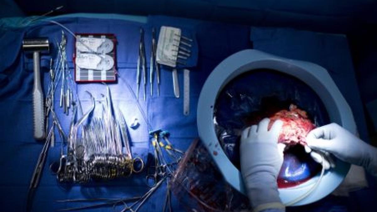 romania risca procedura de infringement in sanatate legea transplantului trebuie reparata