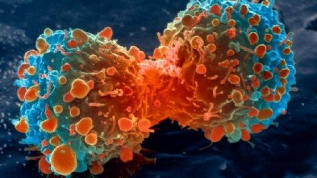descoperire revolutionara in tratamentul cancerului molecula distruge numai celulele canceroase