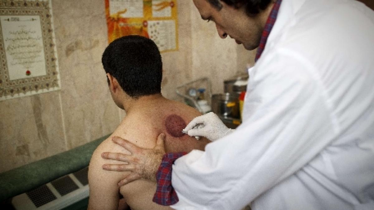 oficial iranian sanctiunile economice afecteaza sase milioane de pacienti grav bolnavi