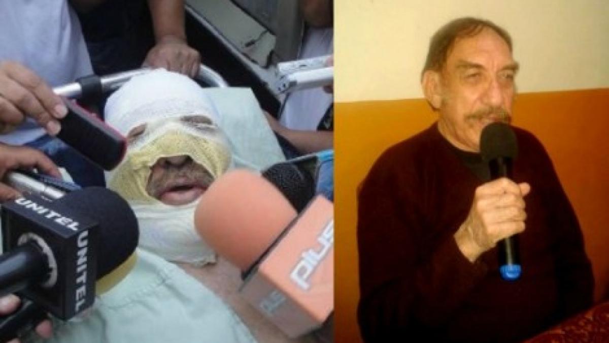 un jurnalist a fost stropit cu benzina si ars de viu in timpul emisiunii sale in direct dezvaluia