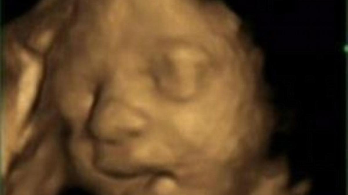 ecografia care a facut inconjurul lumii ce face fatul in pantecele mamei