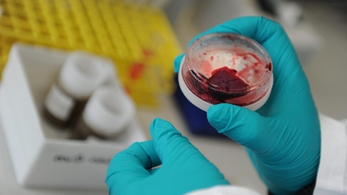 oms a descoperit un nou virus mortal pentru om