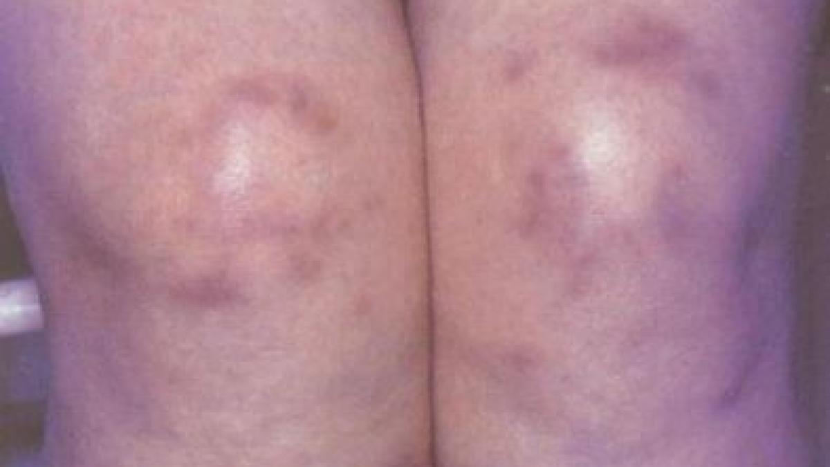 inna plina de sange si vanatai victima a violentei domestice de ce a strans poza 16 000 de like uri