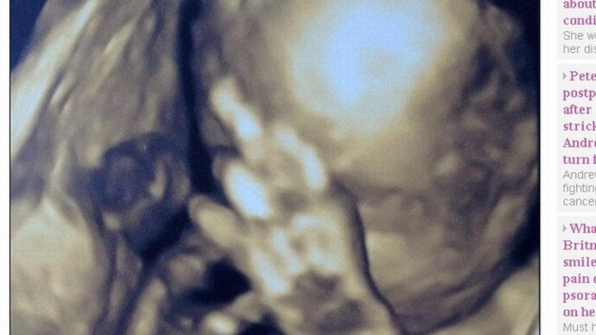 nu ma mai fotografia gestul obscen pe care un fat l a facut in pantecele mamei in timpul ecografiei