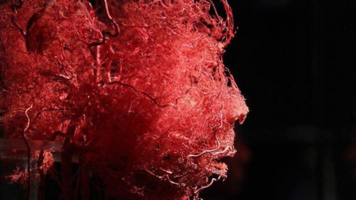 descoperirea care ar putea salva vietile a sute de mii de oameni aparatul identifica din timp