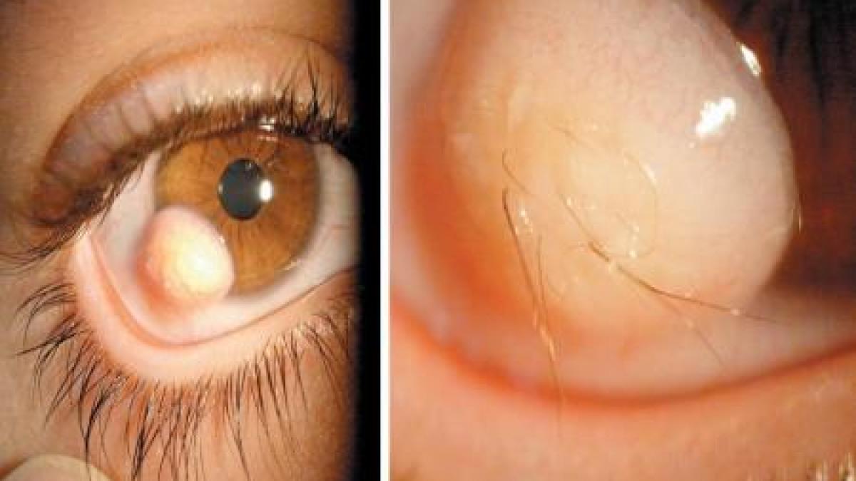 imi creste par in ochi interventia chirurgicala care pare desprinsa dintr un film sf