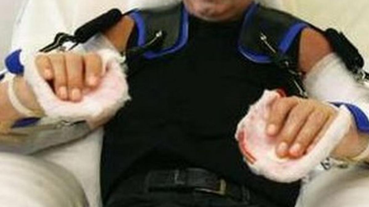 interventie medicala rara un militar american supus unui transplant dublu de brate