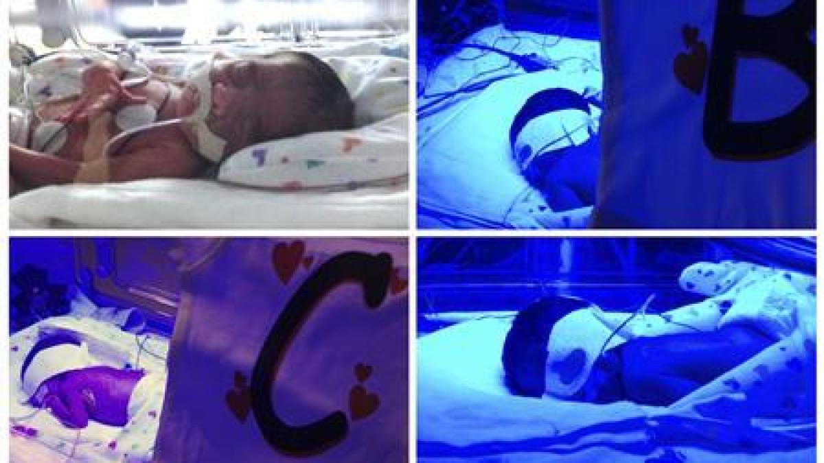 sansa sa se intample era de 1 la 70 de milioane minunea aceasta i a uluit pe medici