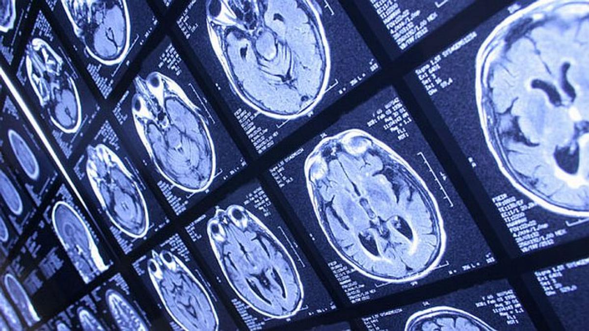 geneticianul care alarmeaza lumea inteligenta omului este in declin pesticidele mancarea si chiar