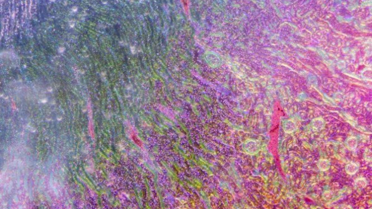 premiera stiintifica cercetatorii au creat celule renale umane din celule stem embrionare