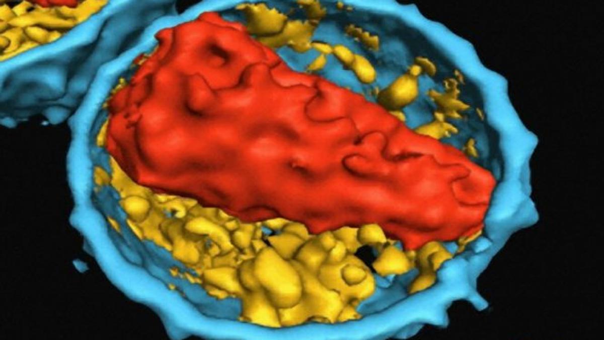 cazul care ar putea revolutiona medicina boala considerata incurabila invinsa cu ajutorul unui