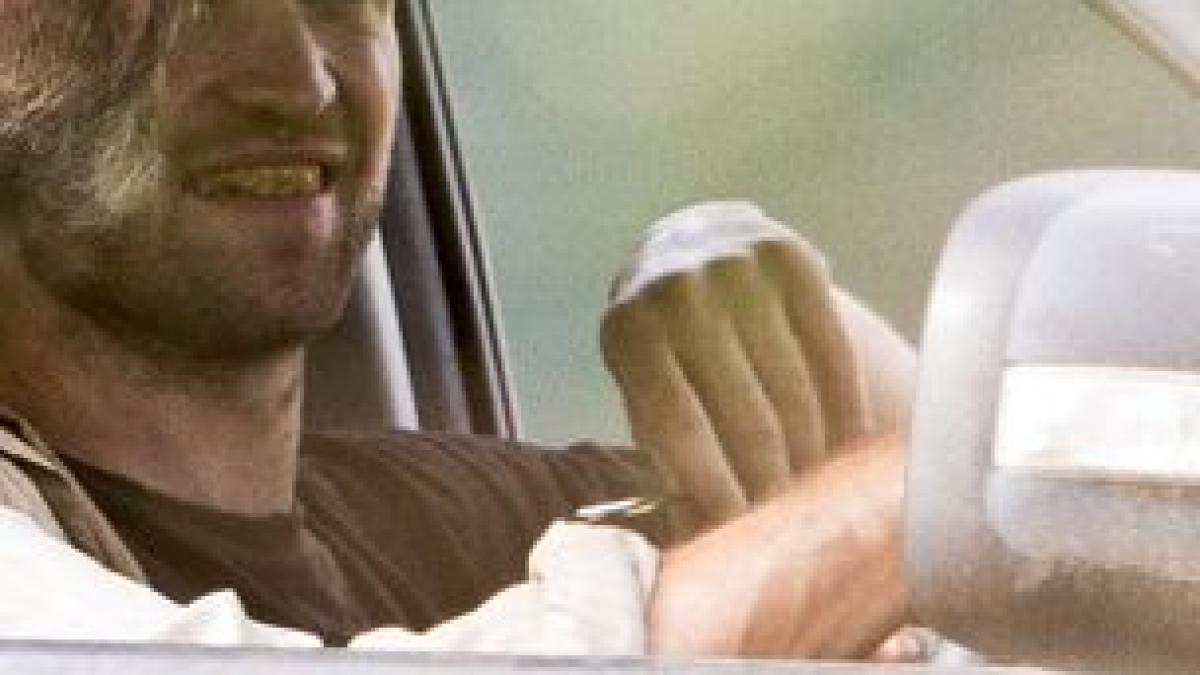 cum arata dintii unuia din cei mai sexy actori de la hollywood nu credeam ca se putea degrada asa