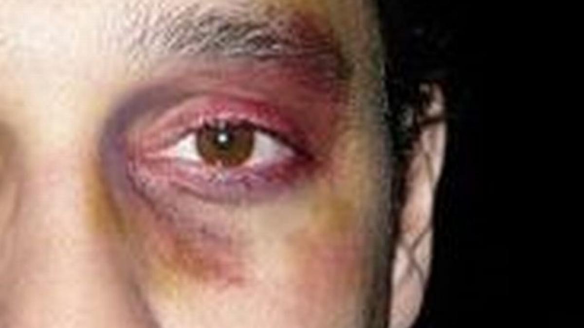 este alarmant ceea ce se intampla in scolile romanesti inca un elev a ajuns la spital dupa ce a