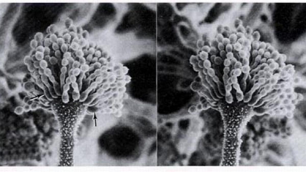 mancarea care ucide ce este aflatoxina substanta cancerigena care se gaseste in sute de produse din